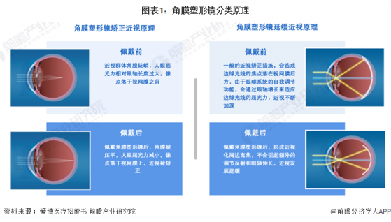 预见2024：《2024年中国角膜塑形镜行业全景图谱》(附市场规模、竞争格局和发展前景等)
