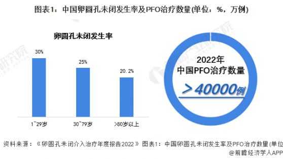 2024年中国心脏封堵器细分市场分析 国产卵圆孔未闭封堵器市场加速发展